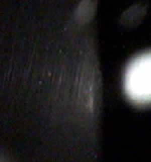 Ceratocone